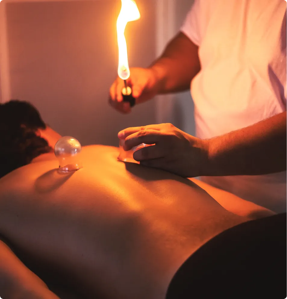 Close-up of a practitioner performing fire cupping therapy on a person’s back using a flame and glass cup.